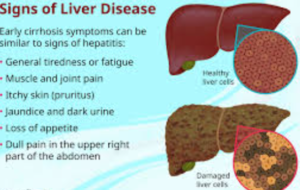 Diagnosis of Liver Disease